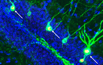 Forskere har opdaget en metode til at danne nye hjerneceller og genoprette hukommelsestab fra Alzheimers